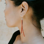 otoplastie